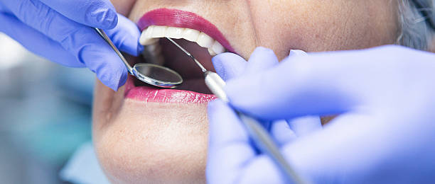 Best Emergency Dentist for Knocked-Out Tooth in Kayak Point, WA